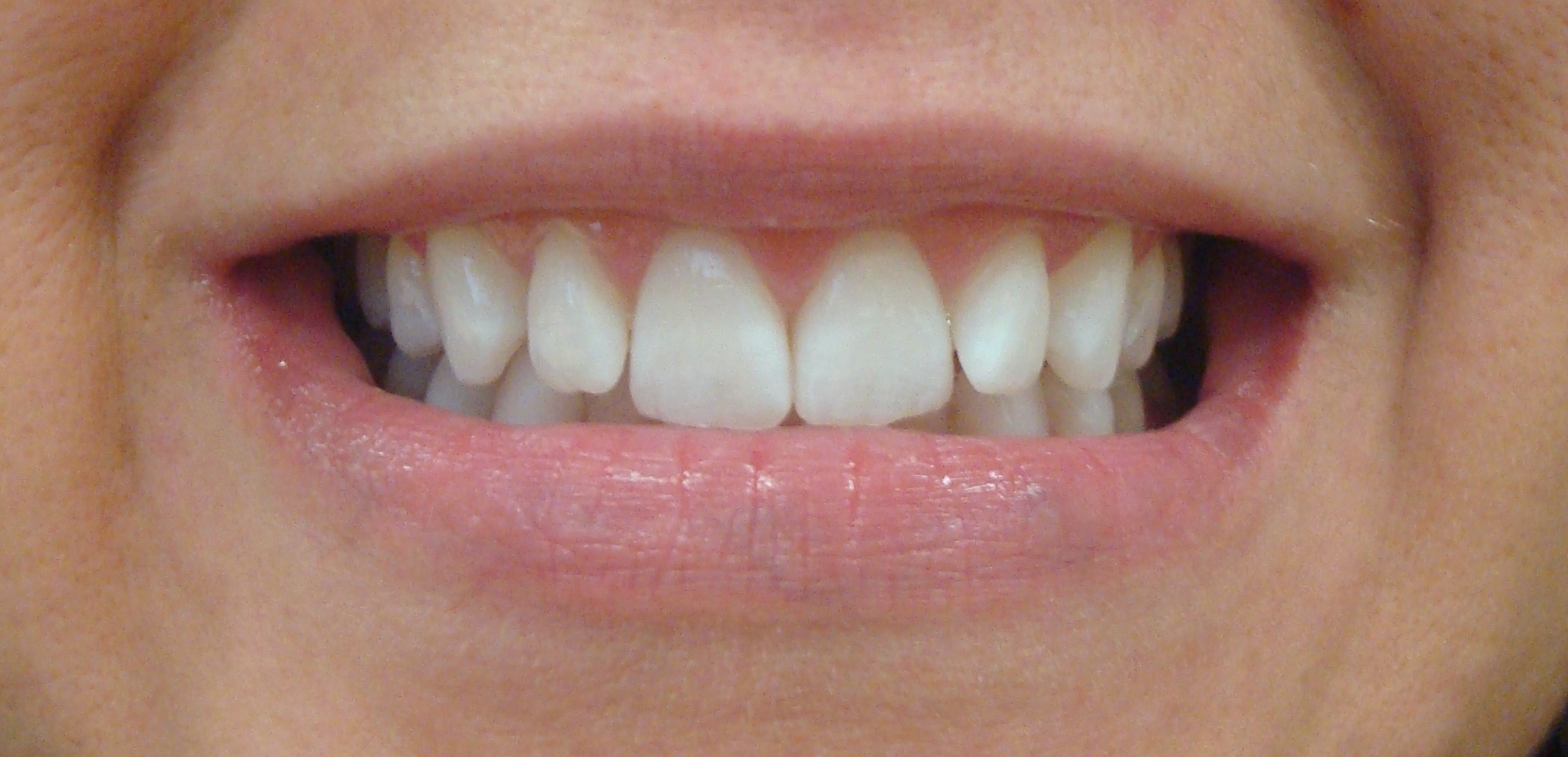 Smile Gallery Fair Oaks, CA Dr. Brian Orcutt